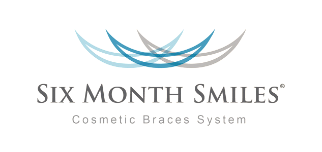 six month smiles braces